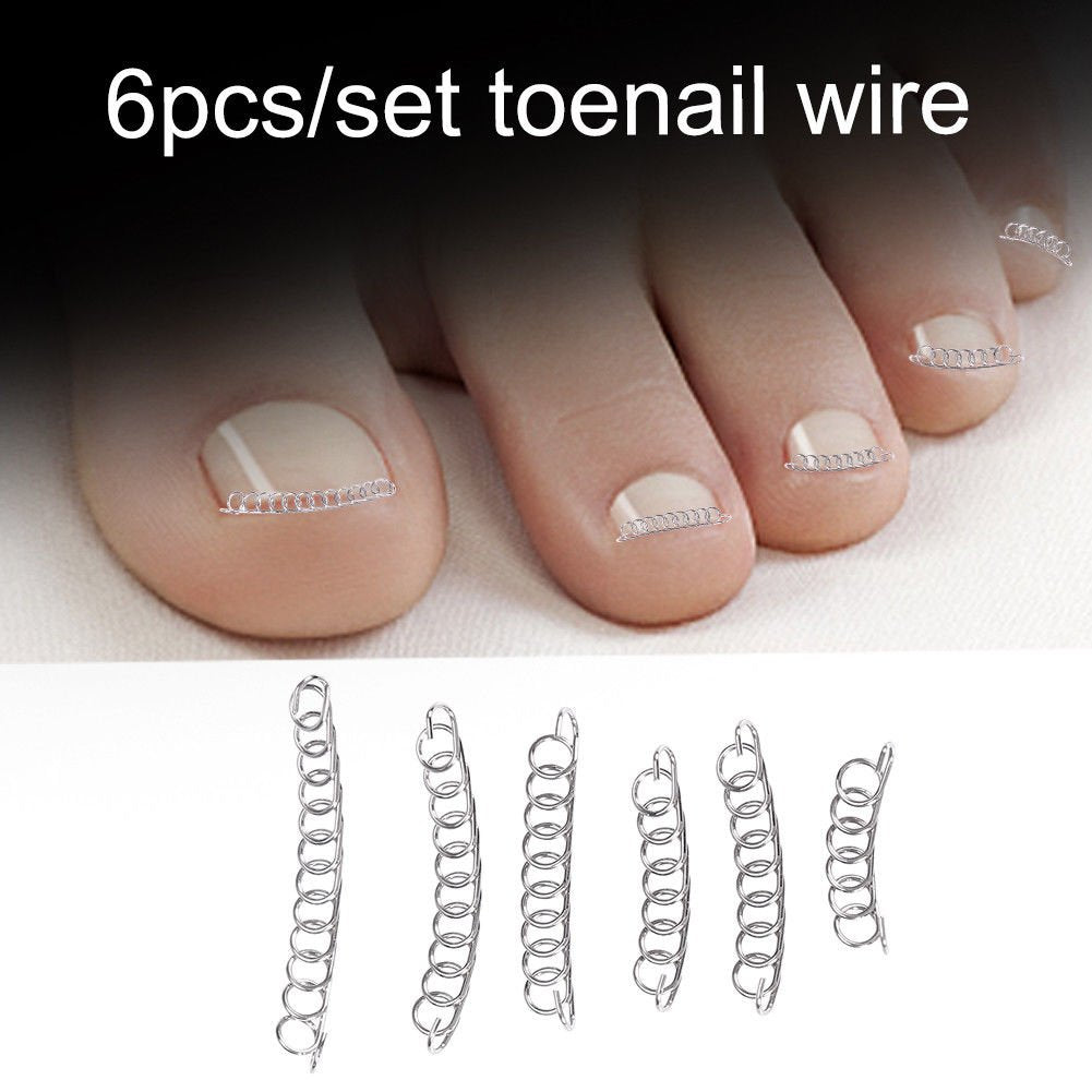 Sozzumi Ingrown Fingernail Correction Wire Nail Corrector Pedicure Foot Care Tool Toenail Correction Tool