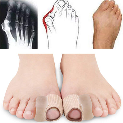 NUCARTURE® Toe separator for women bunion Men, big toe bunion straighteners Hallux Valgus Corrector Bone Thumb Straightener