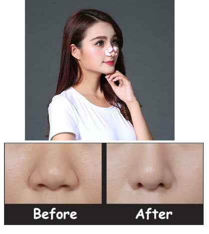sozzumi Nose Shaper Up Lifting Clip for women for big nose, Nose Straightner Tool Slimmer for men, Bridge Straight Nose corrector (Pink)
