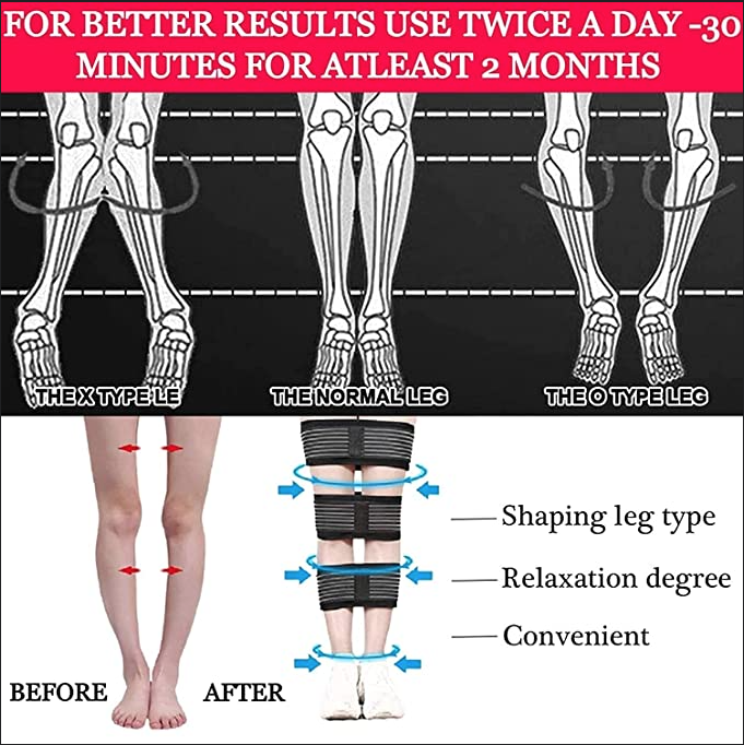Dr Preferred Adjustable bow leg correction, o/x type Legs Posture correction belt for both kids & adults.